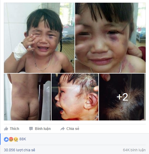 Phẫn nộ cảnh bé gái 3 tuổi bị người cha 