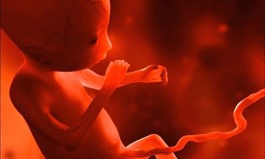 
Hiện tượng bào thai trong bào thai chiếm khoảng 1/500.000 ca sống sót trên toàn thế giới. (Ảnh: Internet)