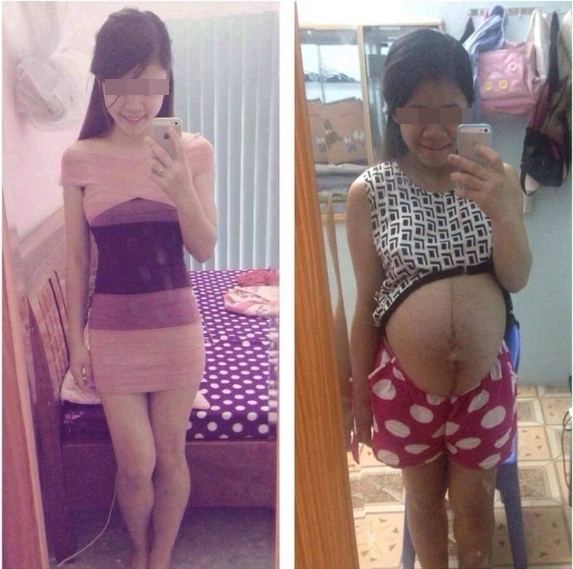 
Hình ảnh trước và trong khi mang bầu của cô gái. (Ảnh: Internet)