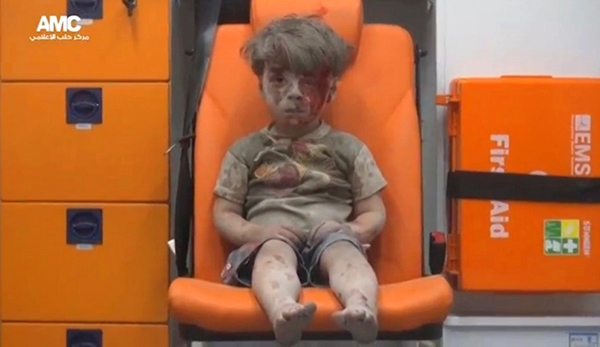 
Hình ảnh cắt từ một video đang được cộng đồng thế giới quan tâm cho thấy một cậu bé người dính đầy bụi bẩn, ngồi bất động thất thần trên xe cứu thương sau cuộc tấn công ở Aleppo, Syria. 