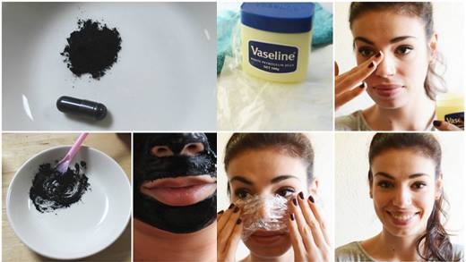 9 công thức cực hiệu quả dễ dàng quét sạch mụn đầu đen