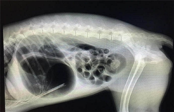 
Ảnh chụp X-quang cho thấy mũi tên nằm xiêng từ xương sườn xuống bụng, chỉ cách các cơ quan quan trọng không đầy 1mm.