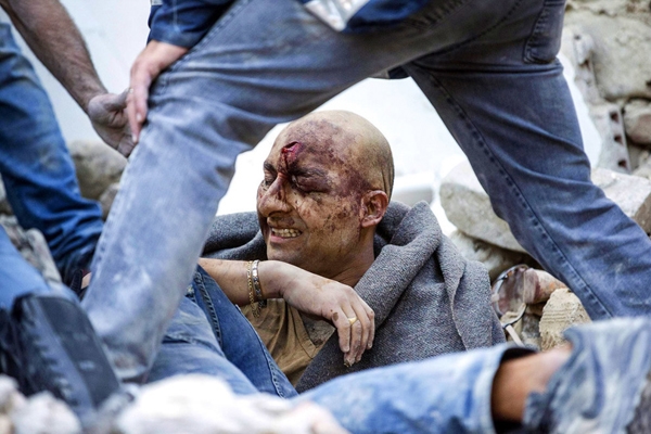 
Một người đàn ông được kéo ra khỏi đống đổ nát sau trận động đất kinh hoàng ở Amatrice, Ý.