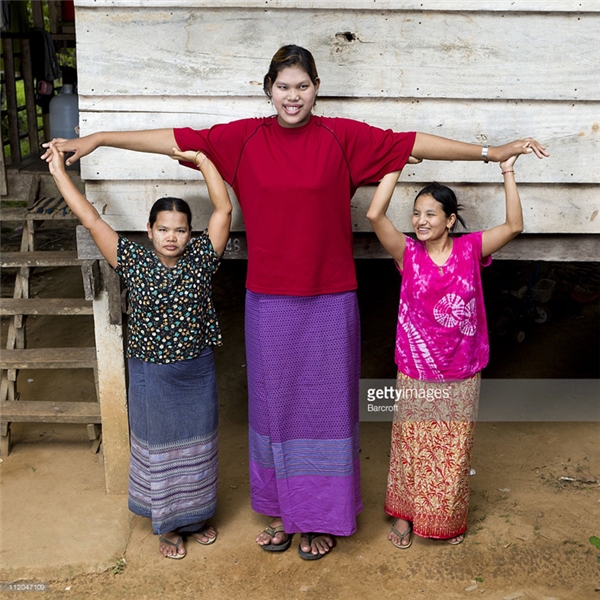 
Malee Duangdee với chiều cao khủng khiếp 2m12, từng được Sách Kỉ lục Guinness công nhận là người phụ nữ cao nhất thế giới.
