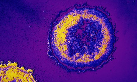 
Hình ảnh virus HIV trong cơ thể người. (Ảnh: Getty)