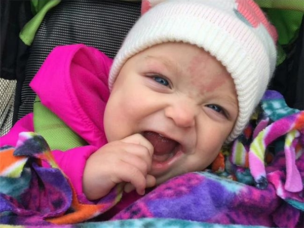 Em bé suýt nghẹn vì chiếc lưỡi khổng lồ đã có thể tươi cười hạnh phúc