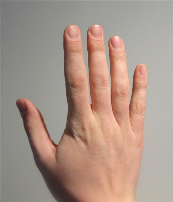 
Có ai nhận ra số #10 chính là phần da ở mỗi khớp ngón tay không? (Ảnh: Internet)