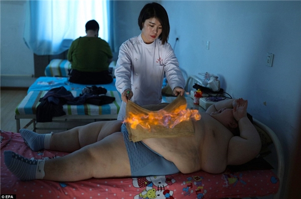 
Gia đình cậu bé đã tìm đến phương pháp y học cổ Truyền Trung Quốc được gọi là "đốt dạ dày".