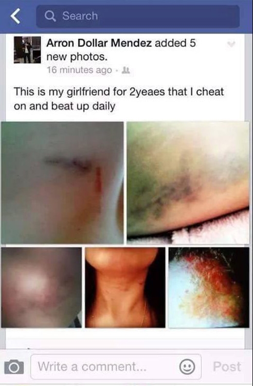 
Đỉnh điểm của sự việc là hắn đăng những tấm ảnh chụp mình mẩy thâm tím của cô lên mạng và dọa sẽ tung cả đoạn video làm nhục cô trong khi đang ngủ.