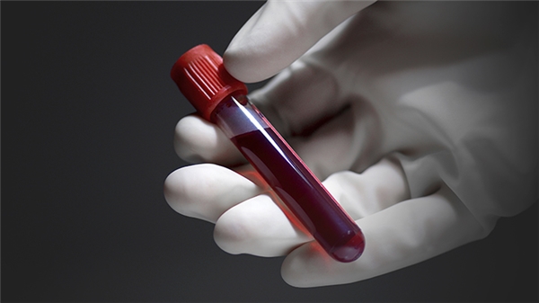 
Dự đoán tuổi thọ con người bằng việc xét nghiệm máu. (Ảnh: internet)