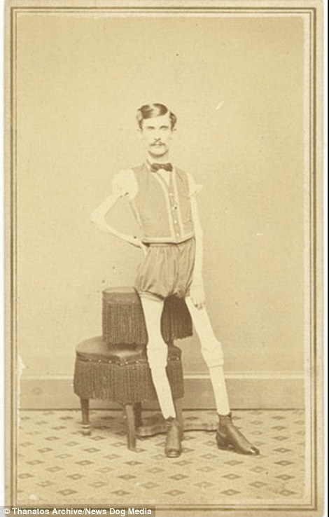 
Issac W. Sprague, còn được biết đến với biệt danh "Bộ xương di động", cao 1,6m và có cân nặng chỉ vỏn vẹn 20,8kg.