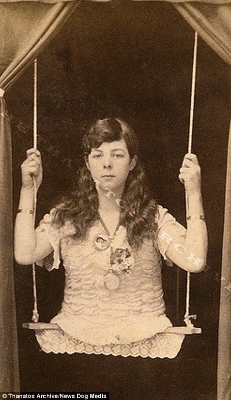 
Hình ảnh một cô gái cụt 2 chân được ghi lại vào những năm 1880.