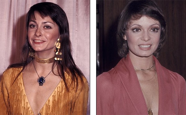 
Năm 1970, vòng cổ choker được biến tấu thành dạng nhiều vòng, chuỗi dài, chuyên mix với áo xẻ sâu, nhằm tạo vẻ sexy mà không quá phản cảm.