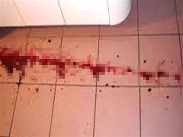 
Vết máu trong nhà vệ sinh kí túc xá. (Ảnh: Sinar Harian)