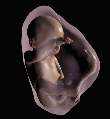 
Hình ảnh 3D của thai nhi.