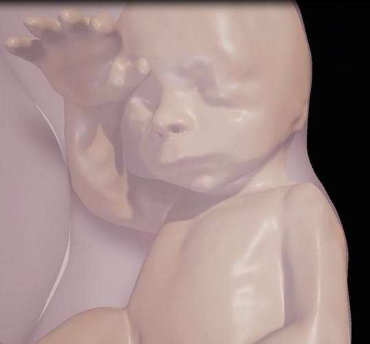 
Chụp cộng hưởng từ cho ra những hình ảnh có độ phân giải cao về thai nhi.