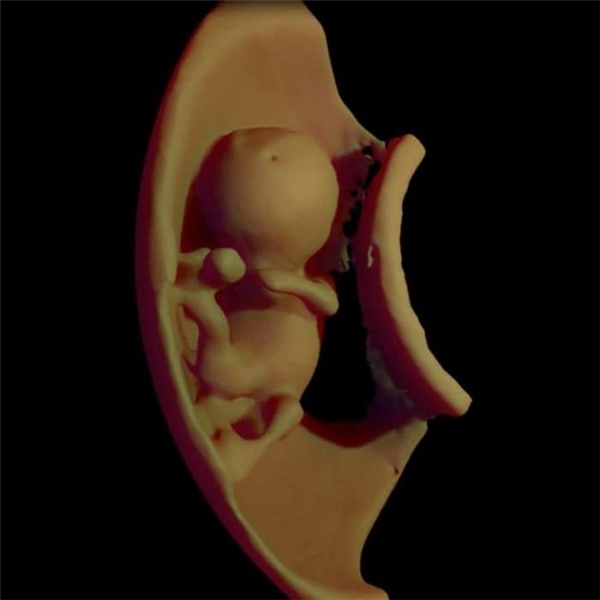 
Mô hình 3D về tử cung, dây rốn, nhau thai và thai nhi.