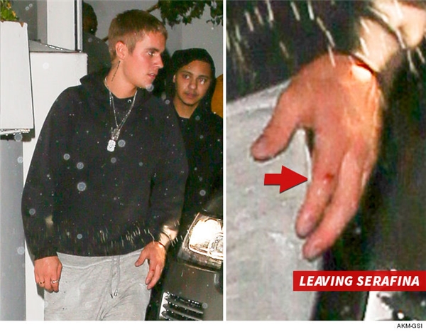 
Justin rời khỏi nhà hàng sau khi húc đầu vào một người ở đó, có thể thấy tay anh đã bị rách và chảy máu.