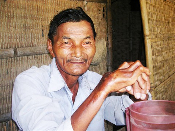Ông Thái Ngọc ở huyện Nông Sơn, tỉnh Quảng Nam, đã không ngủ từ năm 1973 đến nay.